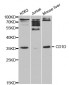 CD1D Antibody